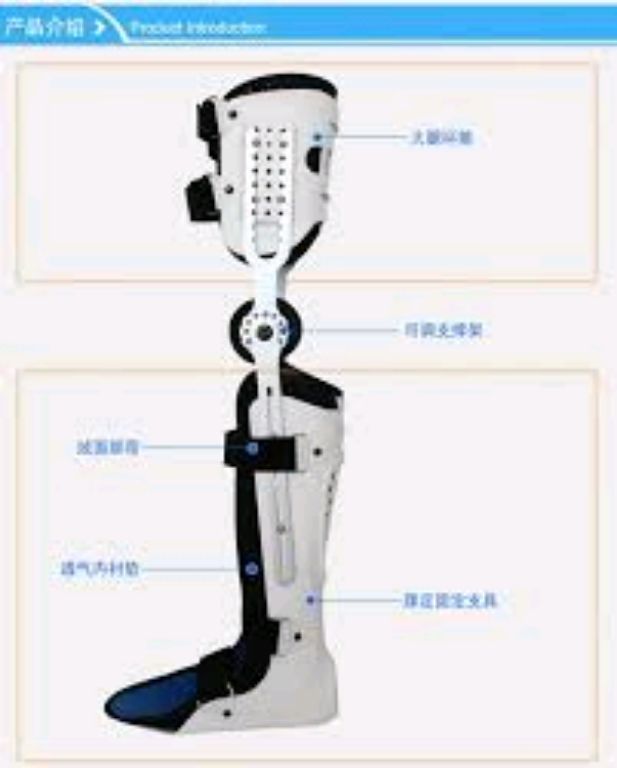 Knee Ankle Foot Fixation By Scantrik