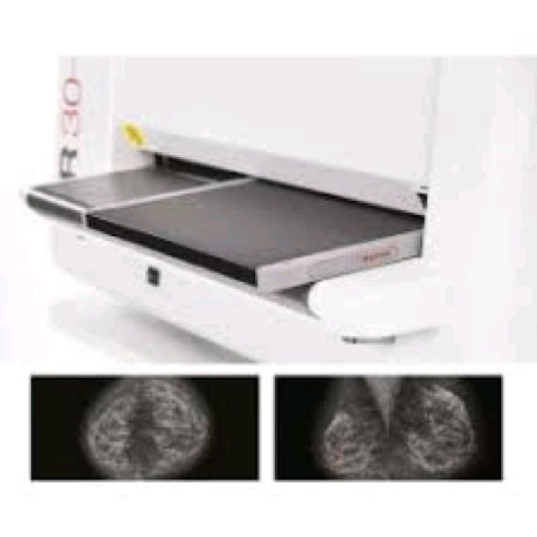 Medical Computed Radiography AGFA Machine By Scantrik