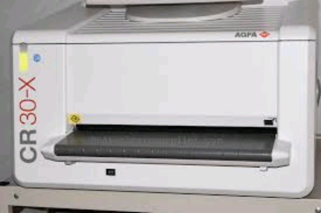 Digital AGFA CR 30X By Scantrik