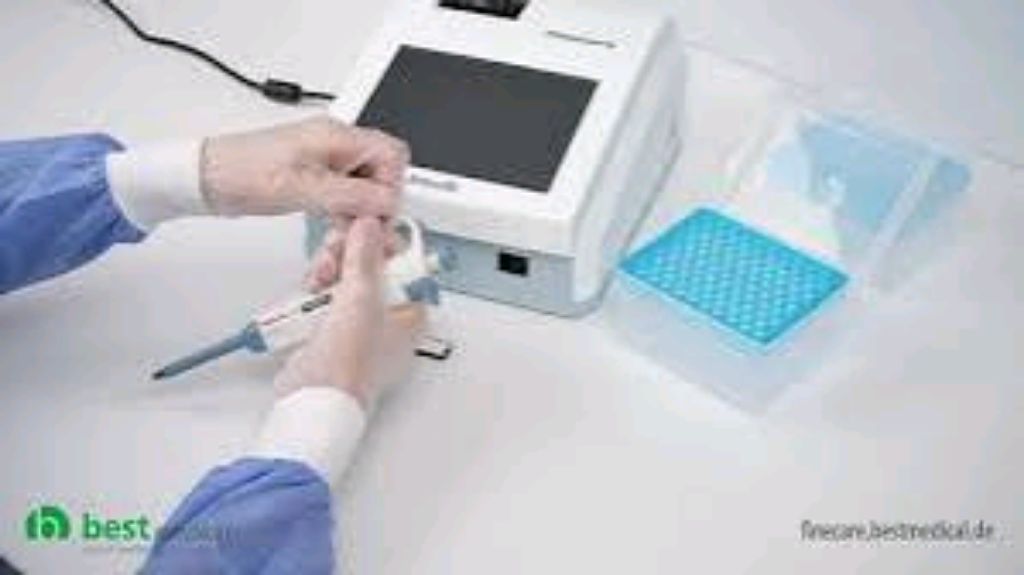 Portable Immunoassay Machine By Scantrik