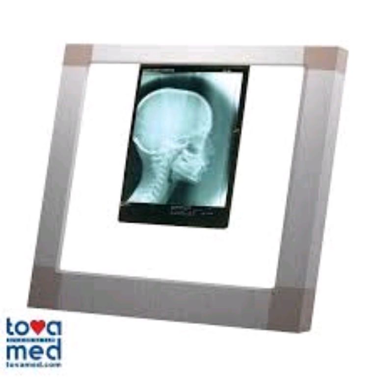 Hospital Medical Film Viewer By Scantrik