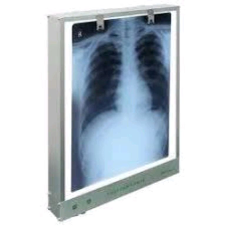 X-ray Viewer View Box By Scantrik