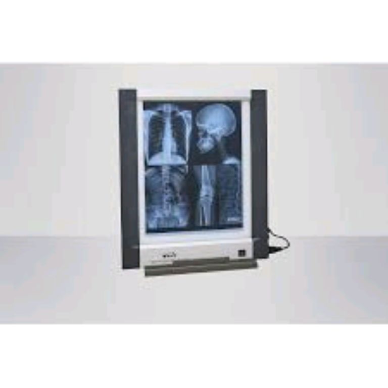 X-ray Film Viewing Box By Scantrik