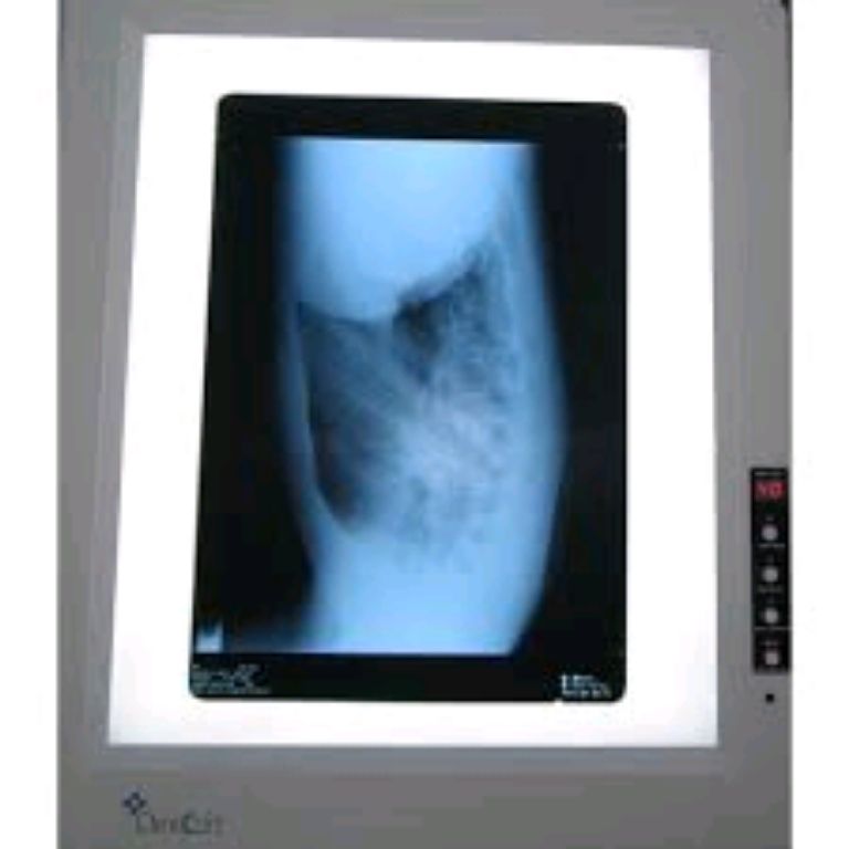 Single X-ray View Box By Scantrik