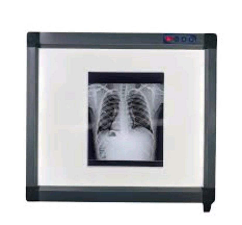 X-ray View Box Single Film By Scantrik