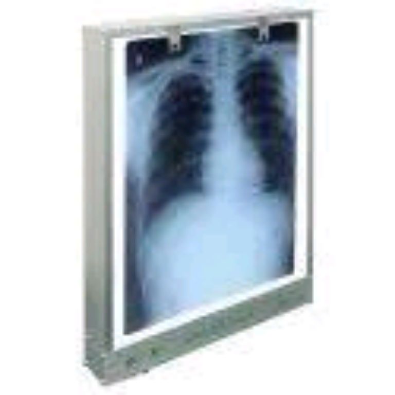 X-ray Viewer Machine By Scantrik