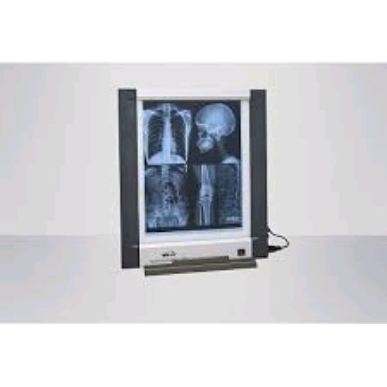 X-ray Viewing Box Single By Scantrik