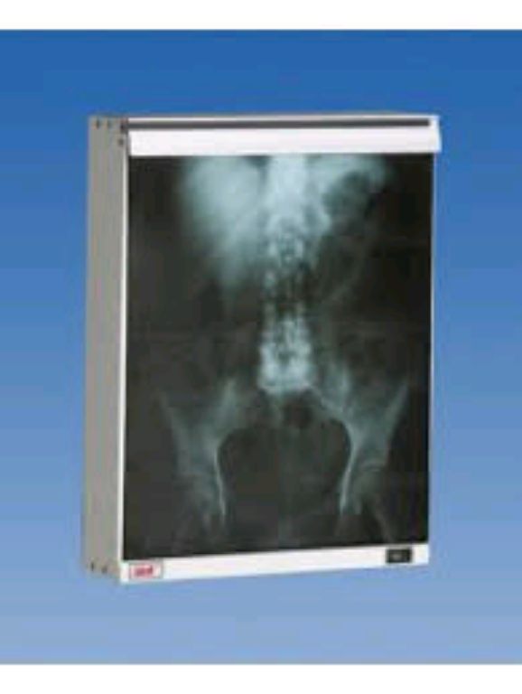 Medical X-ray View Box By Scantrik