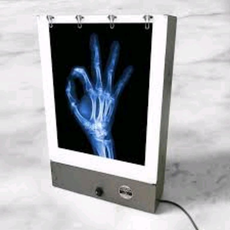 X-ray Viewer By Scantrik