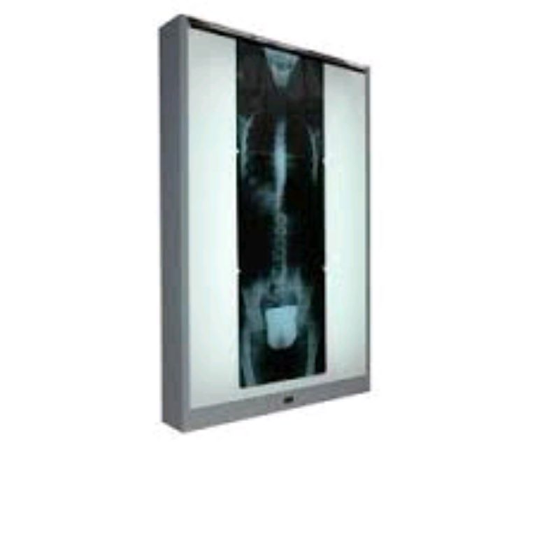 Medical Single X-ray Viewer By Scantrik