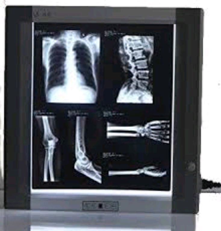 X-ray View Box By Scantrik