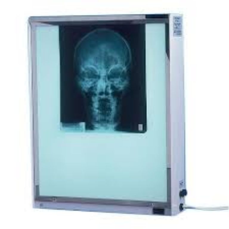Medical X-ray Film Viewer Single Box By Scantrik