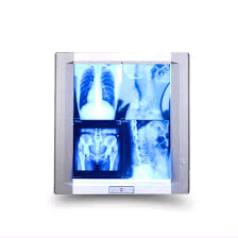 Single Film X-ray Box By Scantrik