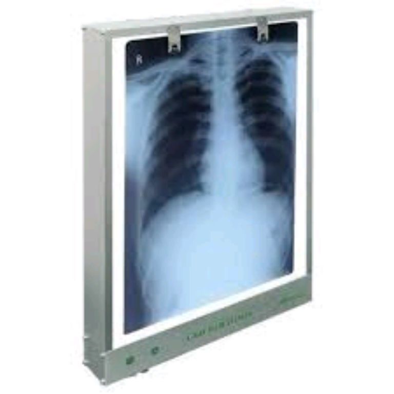 Medical Clinic X-ray View Box By Scantrik