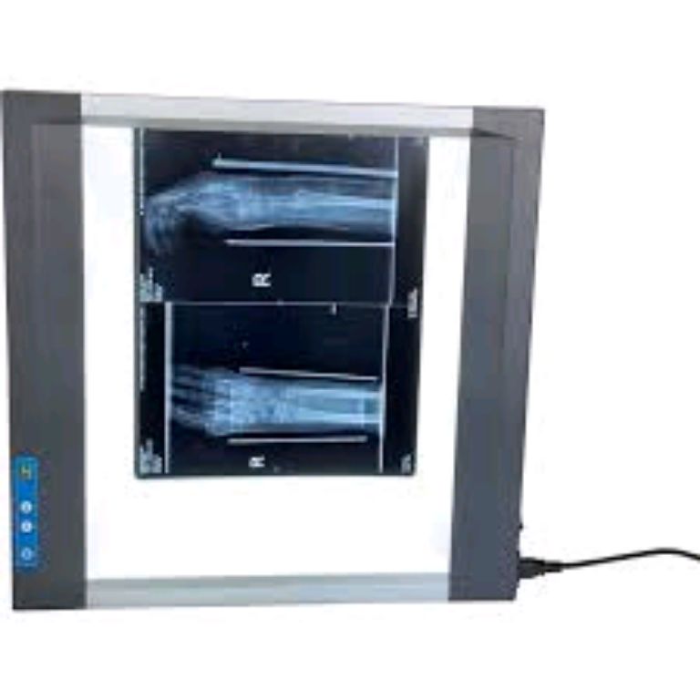Medical X-ray Viewing Box By Scantrik