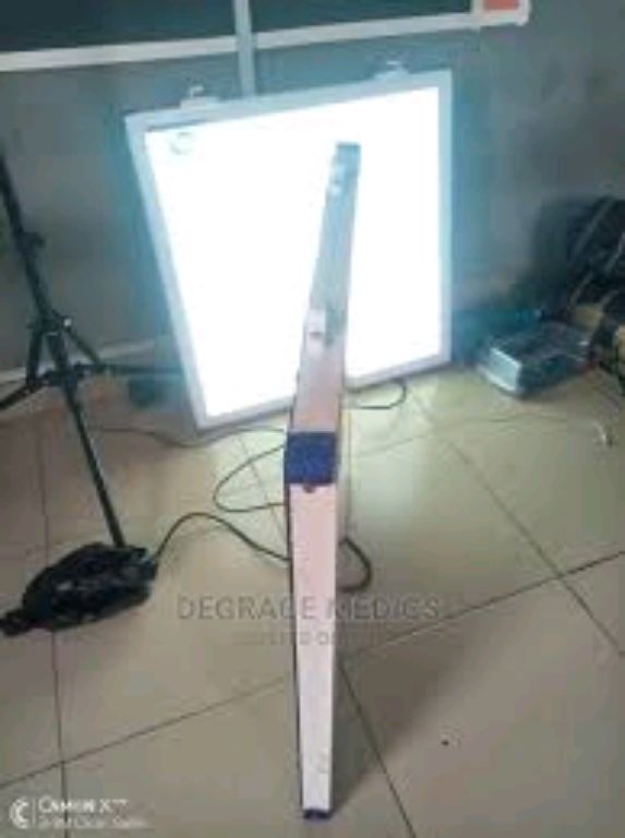 Single X-ray Viewing Box By Scantrik