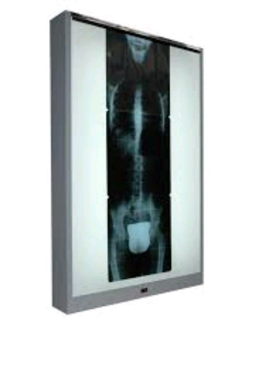 X-ray Viewing Box By Scantrik
