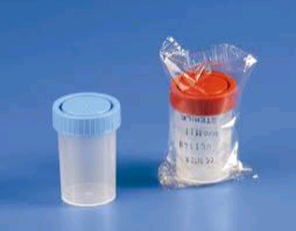 60ml Sterile Urine Container By Scantrik