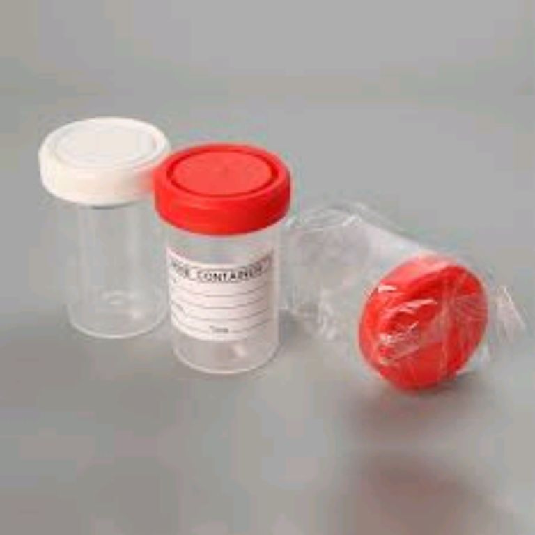 60ml Sterile Urine Container By Scantrik