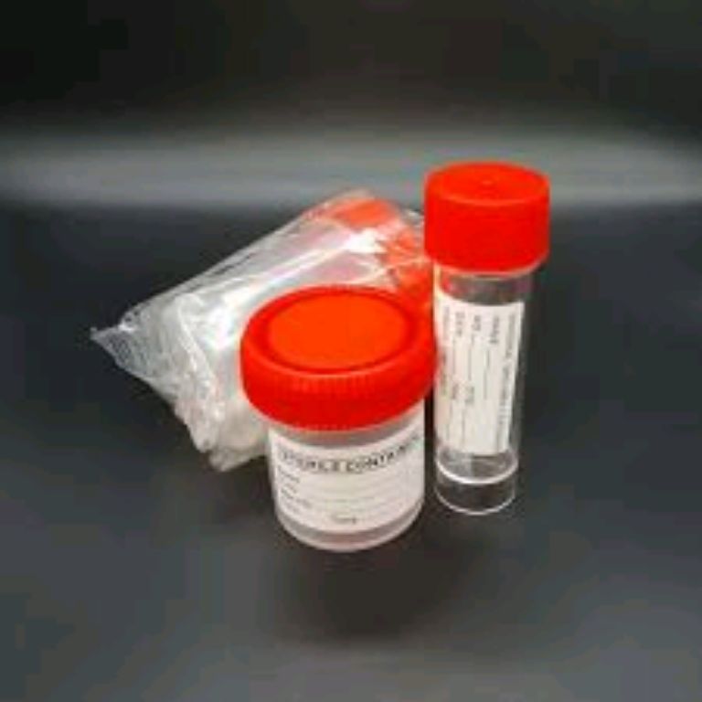 60ml Sterile Urine Container By Scantrik