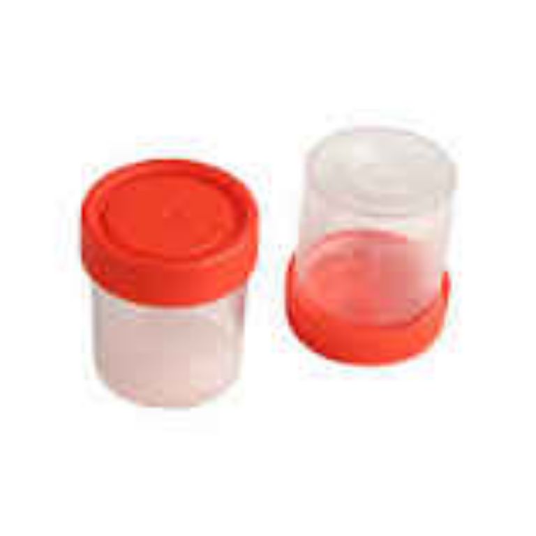 Urine Container 60ml By Scantrik