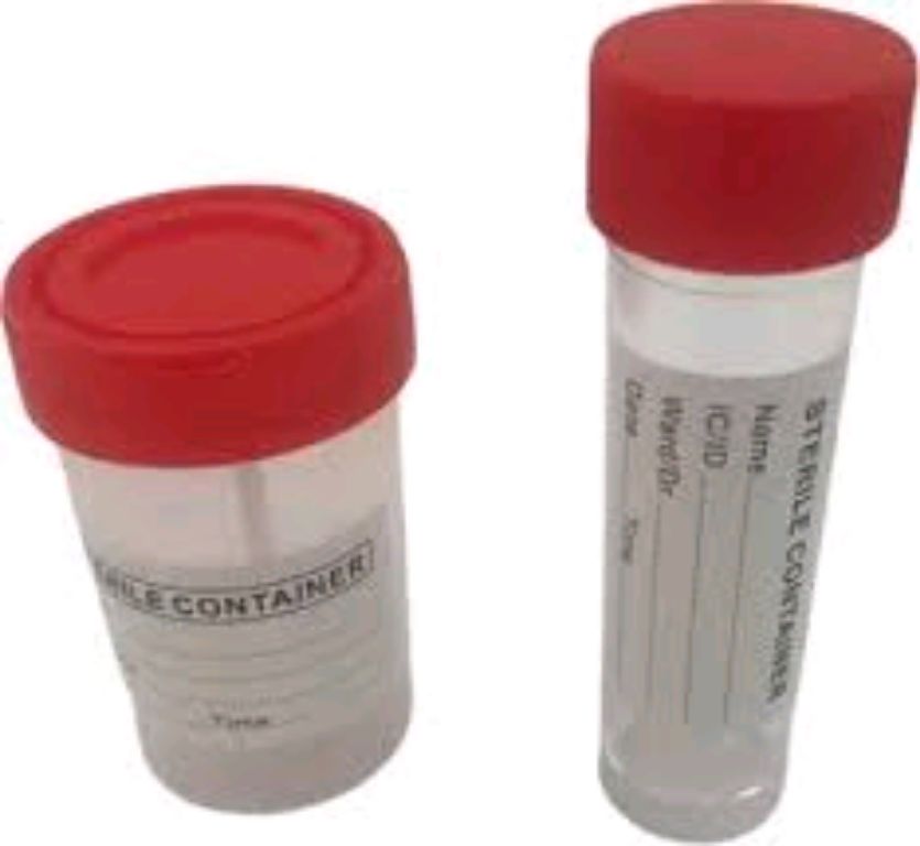 Sterile Urine Container By Scantrik