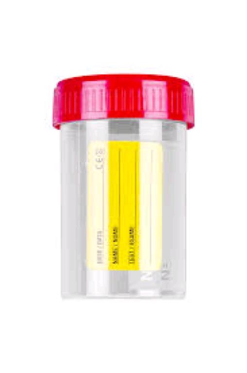 Hospital Urine Container By Scantrik