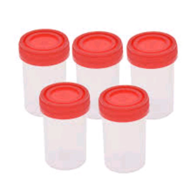 Disposable Urine Container By Scantrik