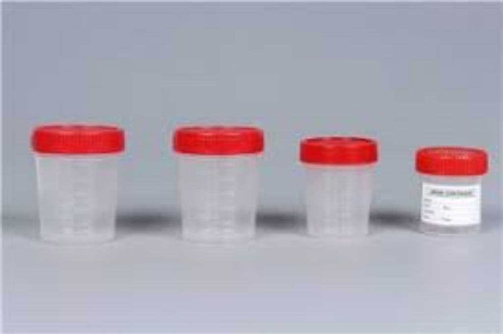 Medical Disposable Urine Container By Scantrik