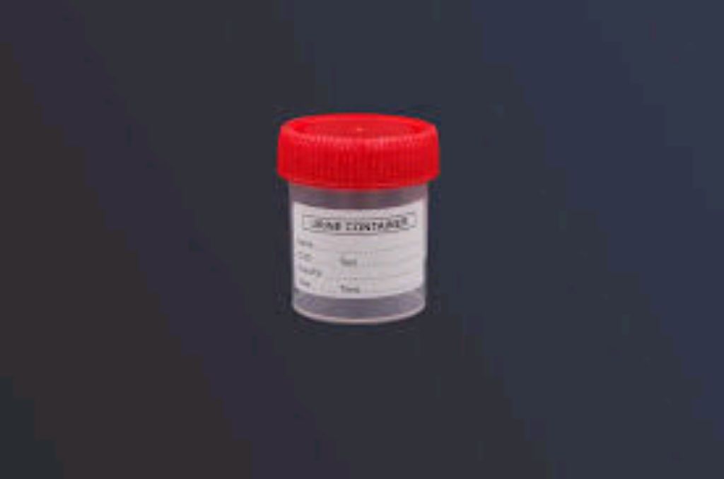 60ml Urine Container 400pcs By Scantrik