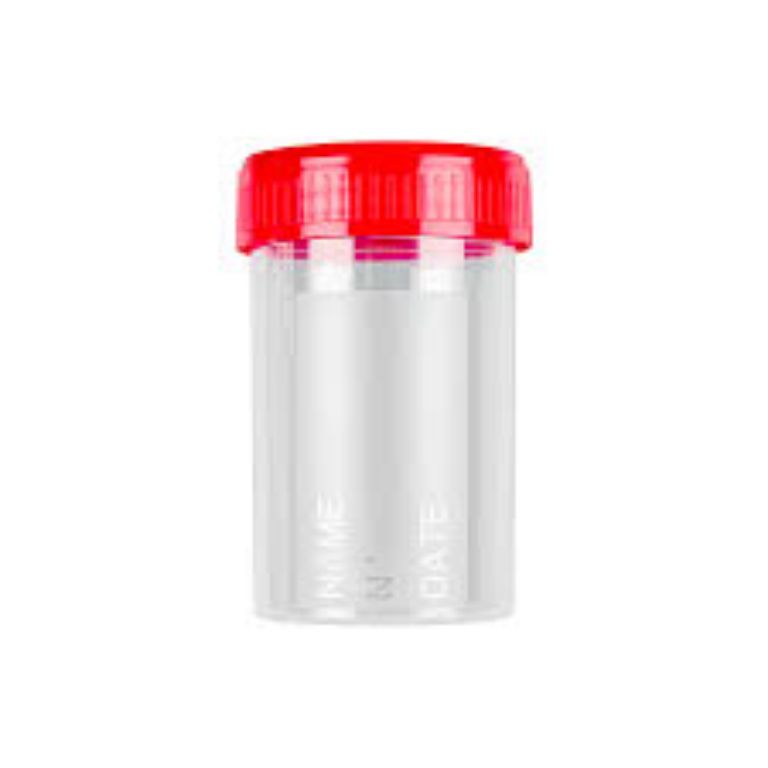 Medical Plastic Urine Container 400pcs By Scantrik