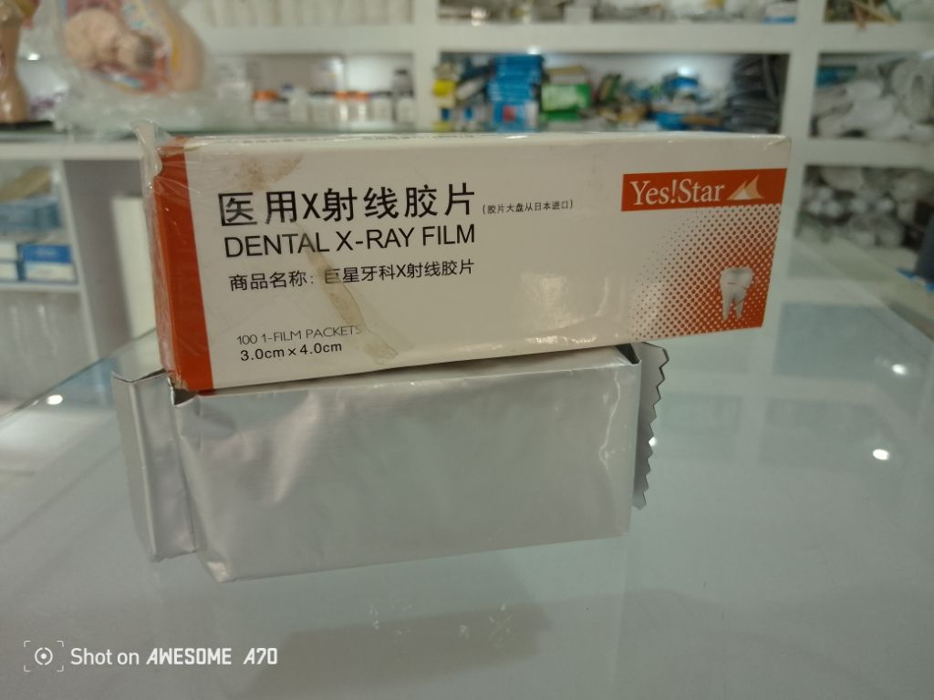Generic Dental X-ray Film By Scantrik