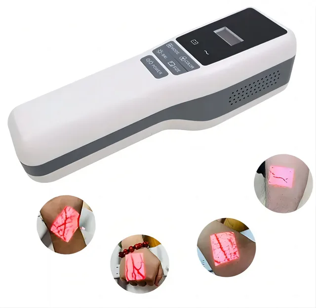 Portable vain finder by Scantrik