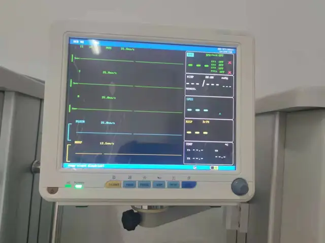 Vital signs monitor by Scantrik