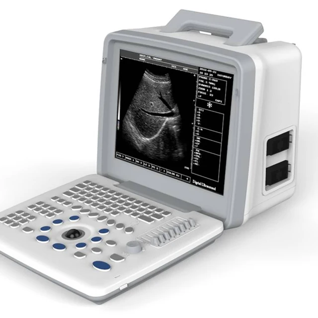 Ultrasound Human Diagnostics Machine by Scantrik