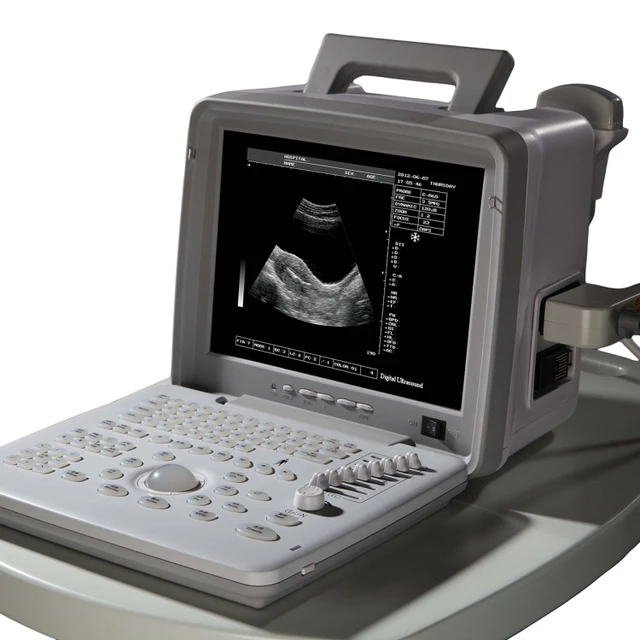 Full Digital Ultrasound by Scantrik