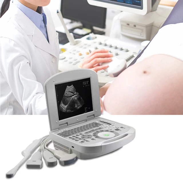 Sunbright Ultrasound Laptop Machine with Convex probe by Scantrik