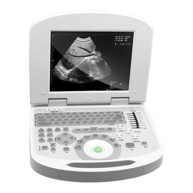 Black and White Ultrasound Laptop Machine by Scantrik