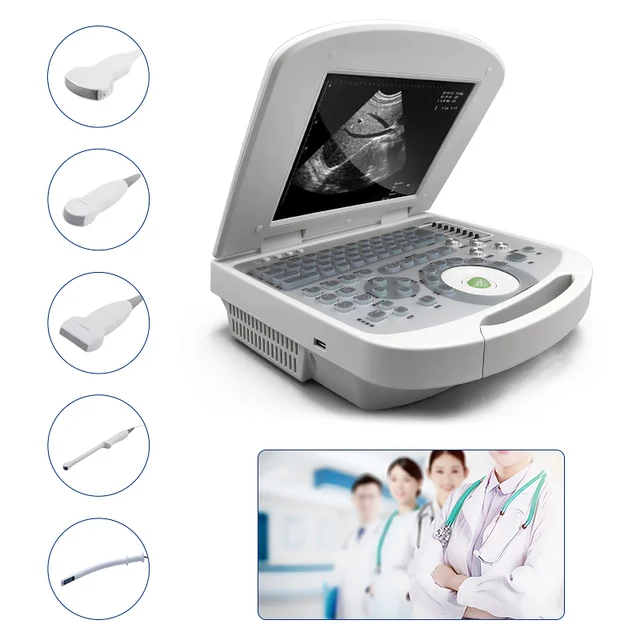 Ultrasound Laptop Machine by Scantrik