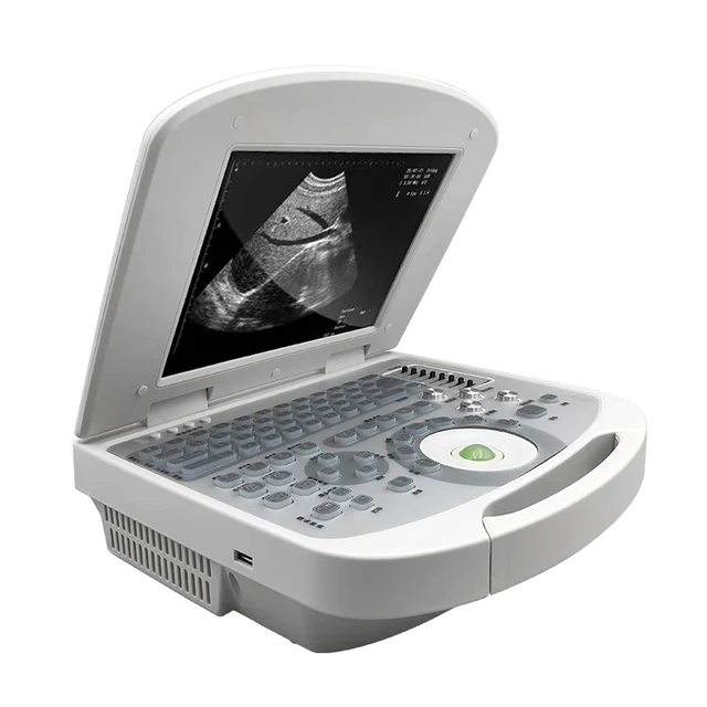 Sunbright Portable Ultrasound Laptop by Scantrik