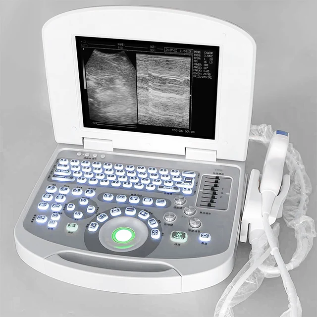 Sunbright Portable Laptop Ultrasound Machine with Convex Probe(Black&White) by Scantrik