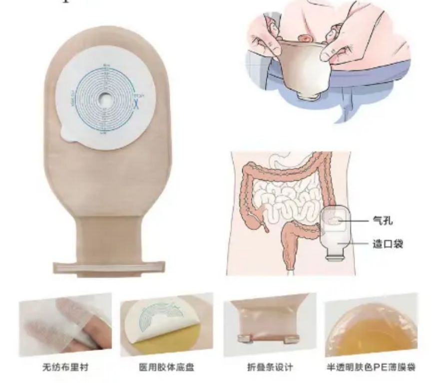 Colostomy Kit by Scantrik