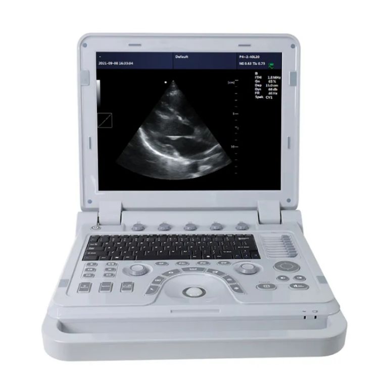 Ultrasound Machine by Scantrik