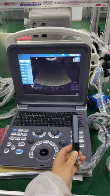 Fetal Ultrasound Device by Scantrik