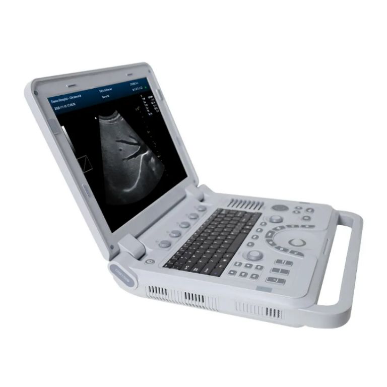 4D Ultrasound Machine by Scantrik