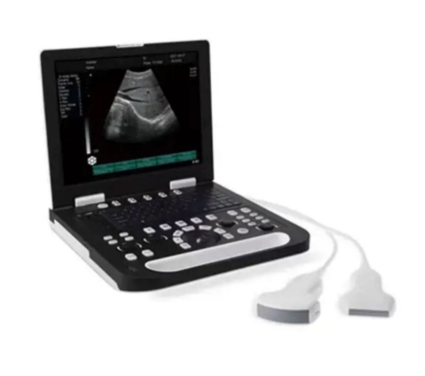 Ultrasonography Device by Scantrik