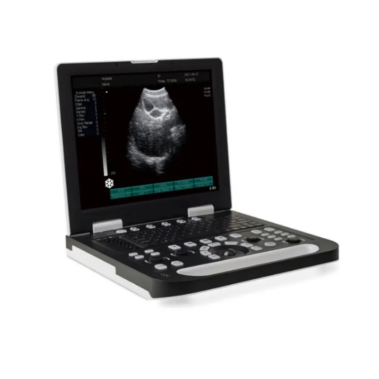 Ultrasound Scanner by Scantrik