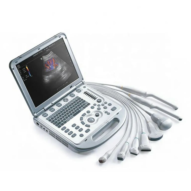 Sonogram Machine by Scantrik