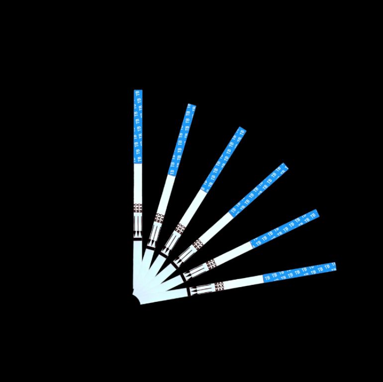 Mycobacterial Infection Assessment Kit by Scantrik