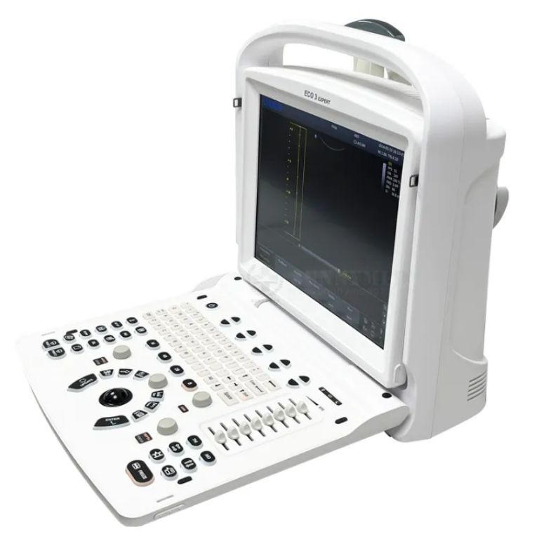 Sunbright VisuScan Laptop Ultrasound by Scantrik